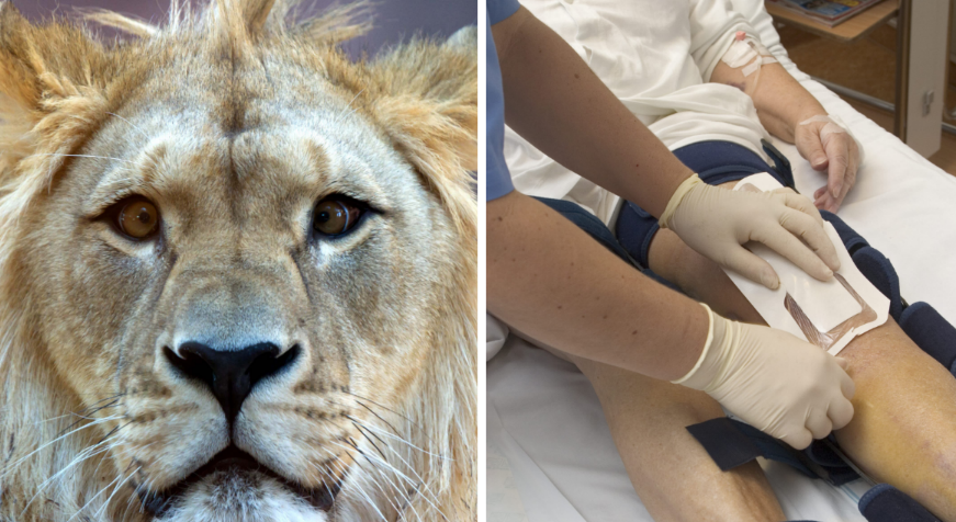 Lejonet slet sönder 18-åringens ben.